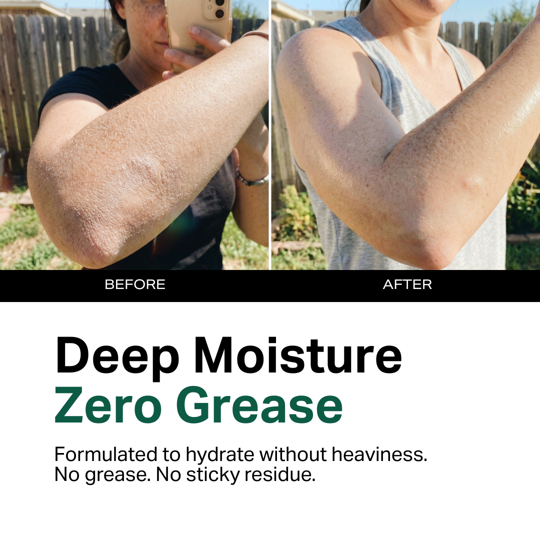 Moisturizing Body Lotion