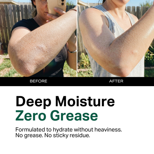 Moisturizing Body Lotion