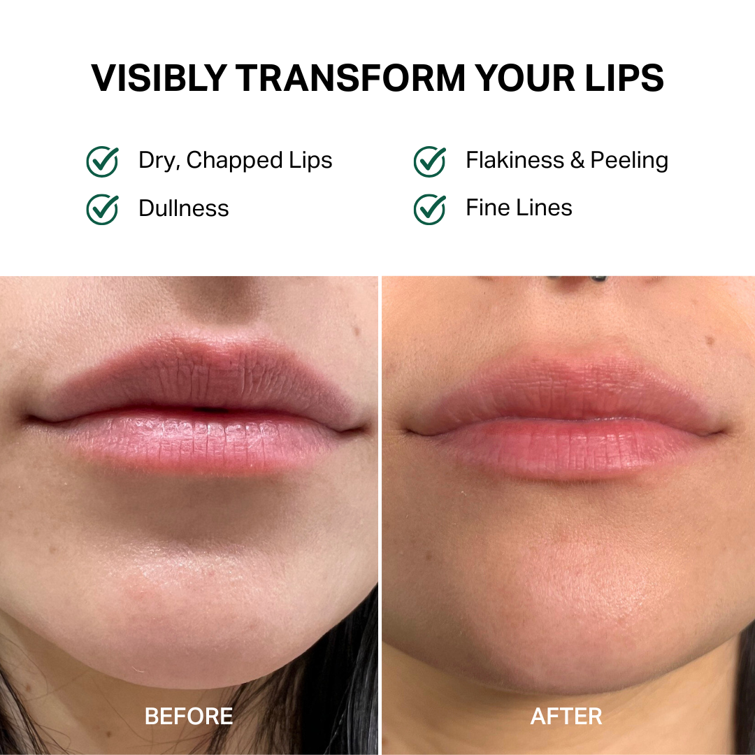 Lip Balm