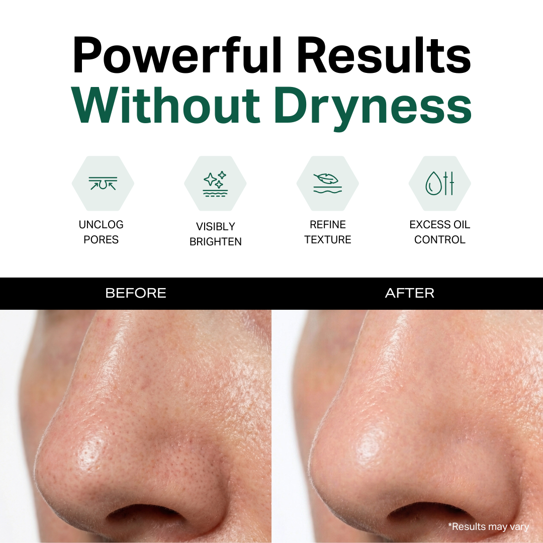 Blemish-Free Mask
