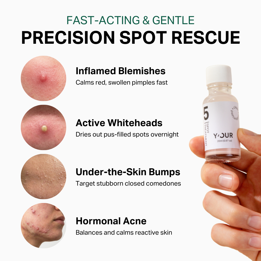 Spot Treatment