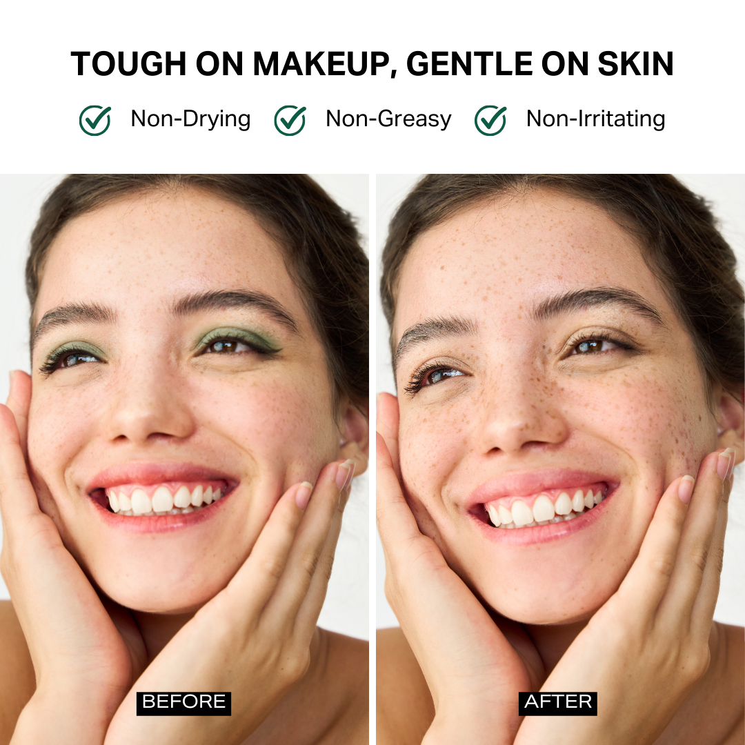 Makeup Remover