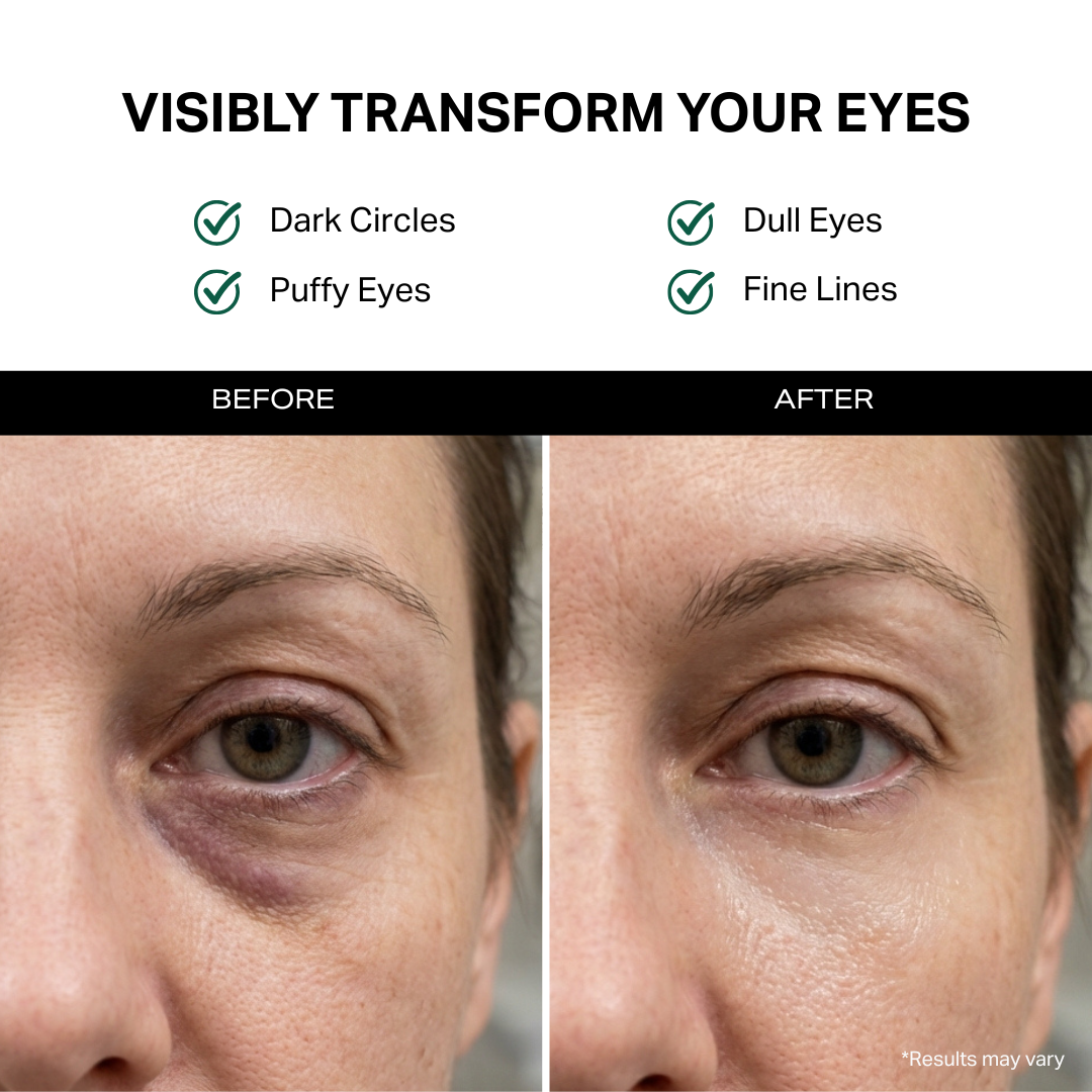 Eye Cream