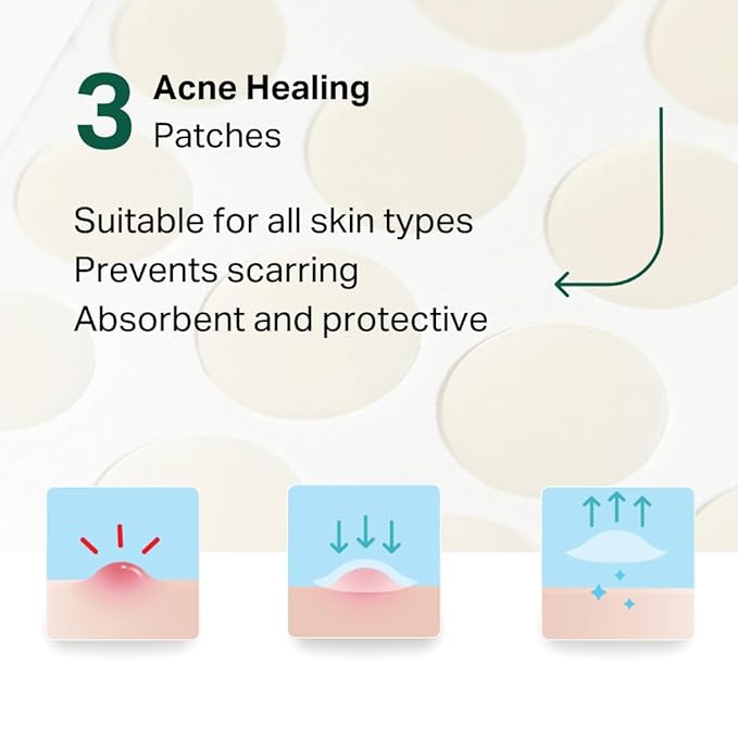 Essential 3-Step Acne Kit