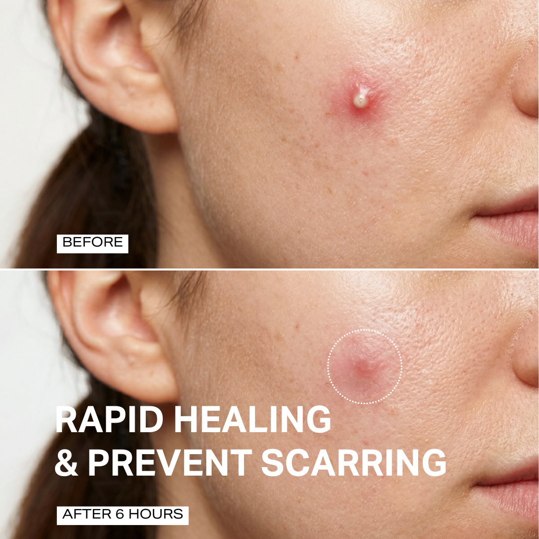 Spot Treatment