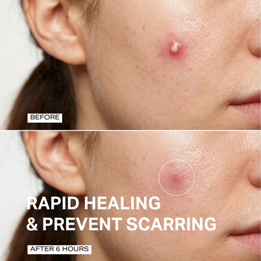 Spot Treatment